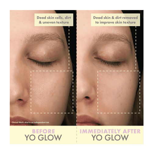 Wishful Yo Glow AHA & BHA Facial Enzyme Scrub 100ml